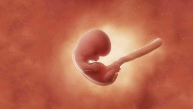تصویر در مدت نفاسِ مادری که جهت سقط جنین مجبور به سزارین می شود