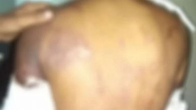 تصویر در تتوی اسلامی باعث قطع دست یک جوان هندی شد